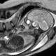Illustration for article titled The First MRI of Birth: A Baby Looking At His Mom's Vagina